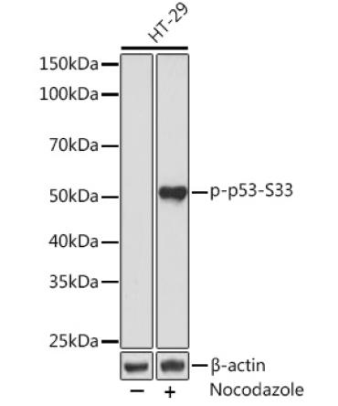Phospho-p53-S33 Rabbit Monoclonal Antibody