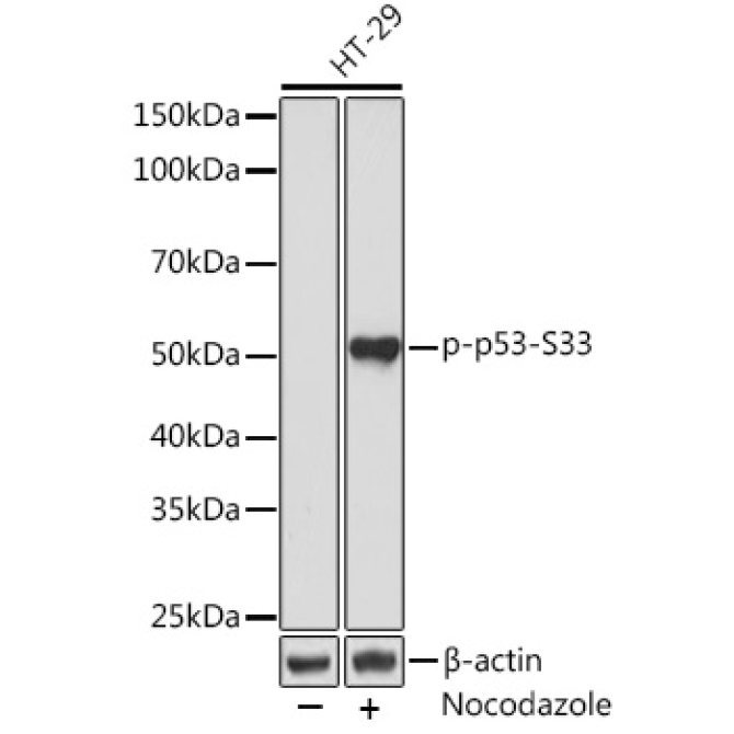 Phospho-p53-S33 Rabbit Monoclonal Antibody