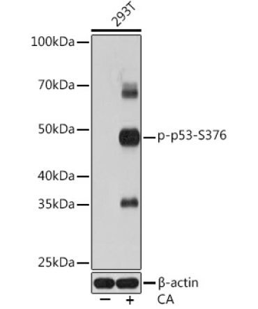 Phospho-p53-S376 Rabbit Monoclonal Antibody
