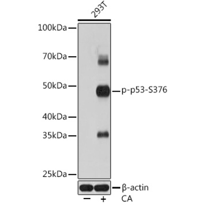 Phospho-p53-S376 Rabbit Monoclonal Antibody
