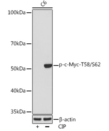Phospho-c-Myc-T58/S62 Rabbit Monoclonal Antibody