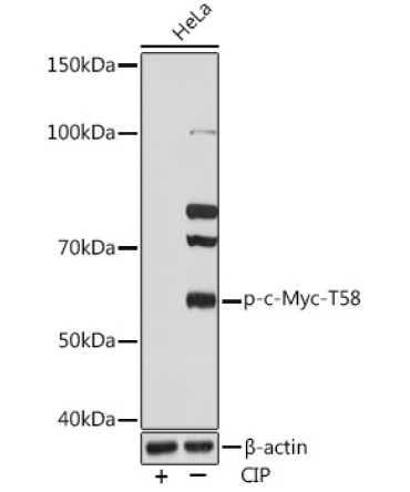 Phospho-c-Myc-T58 Rabbit Monoclonal Antibody