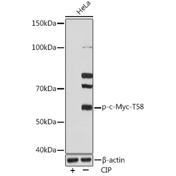 Phospho-c-Myc-T58 Rabbit Monoclonal Antibody