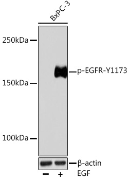 Phospho-EGFR-Y1173 Rabbit Monoclonal Antibody