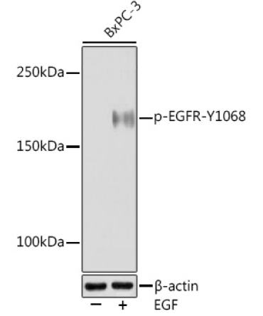 Phospho-EGFR-Y1068 Rabbit Monoclonal Antibody