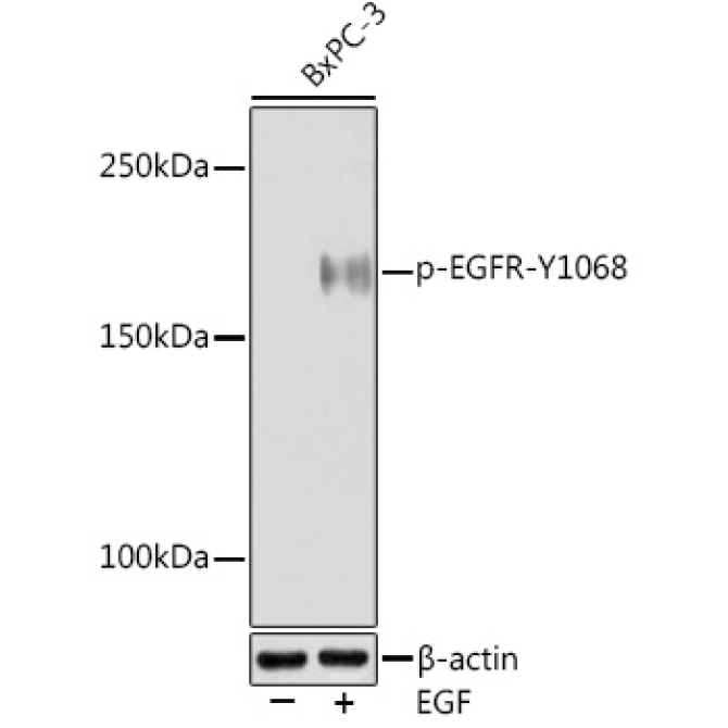 Phospho-EGFR-Y1068 Rabbit Monoclonal Antibody