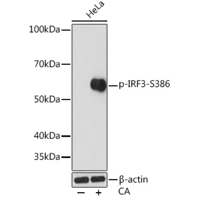 Phospho-IRF3-S386 Rabbit Monoclonal Antibody