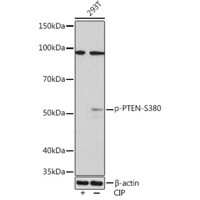Phospho-PTEN-S380 Rabbit Monoclonal Antibody