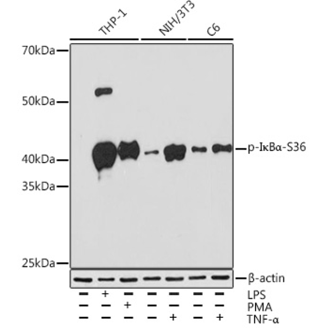Phospho-I?BAlpha-S36 Rabbit Monoclonal Antibody