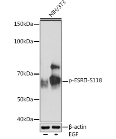 Phospho-ESRAlpha-S118 Rabbit Monoclonal Antibody