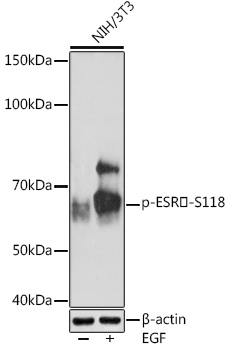 Phospho-ESRAlpha-S118 Rabbit Monoclonal Antibody
