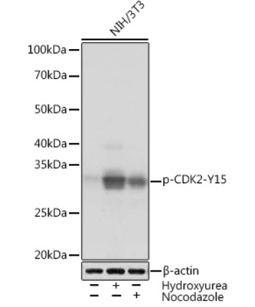 Phospho-CDK2-Y15 Rabbit Monoclonal Antibody