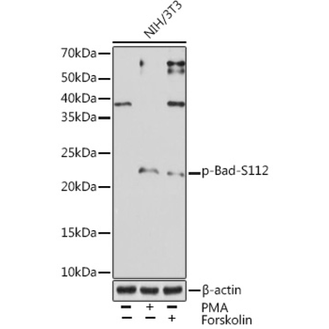Phospho-Bad-S112 Rabbit Monoclonal Antibody