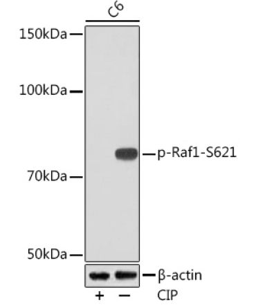Phospho-Raf1-S621 Rabbit Monoclonal Antibody