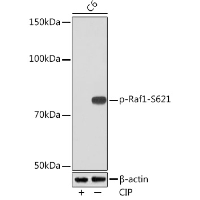 Phospho-Raf1-S621 Rabbit Monoclonal Antibody