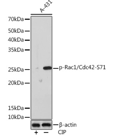 Phospho-Rac1/Cdc42-S71 Rabbit Monoclonal Antibody