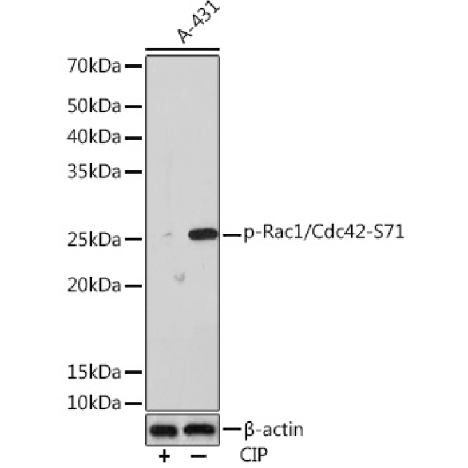 Phospho-Rac1/Cdc42-S71 Rabbit Monoclonal Antibody
