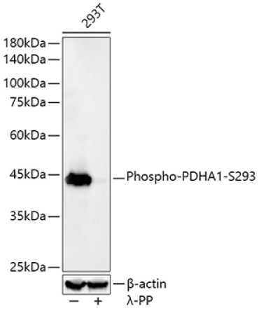 Phospho-PDHA1-S293 Rabbit Monoclonal Antibody
