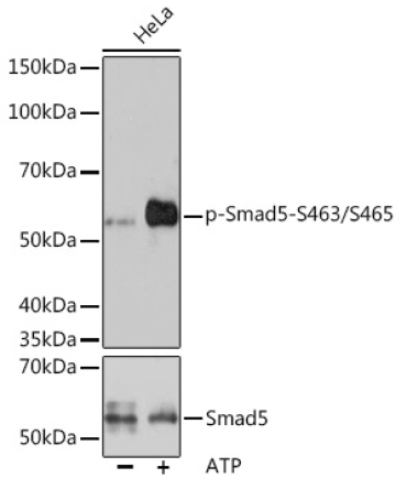 Phospho-Smad5-S463/S465 Rabbit Monoclonal Antibody