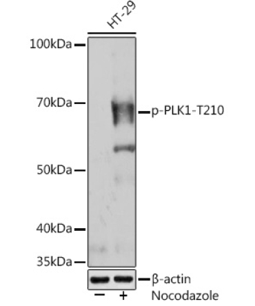 Phospho-PLK1-T210 Rabbit Monoclonal Antibody
