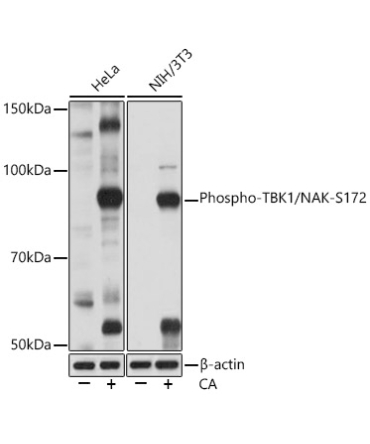 Phospho-TBK1/NAK-S172 Rabbit Monoclonal Antibody