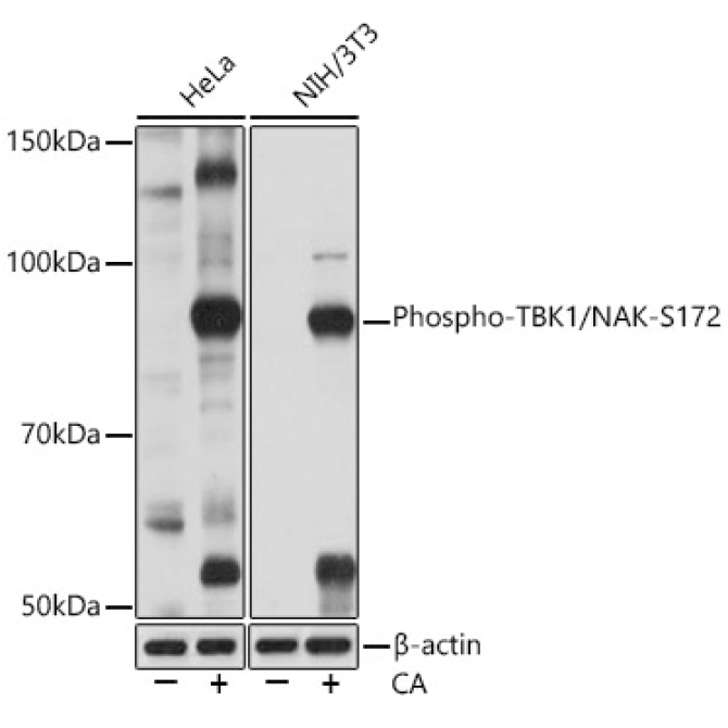 Phospho-TBK1/NAK-S172 Rabbit Monoclonal Antibody