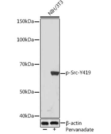 Phospho-Src-Y419 Rabbit Monoclonal Antibody