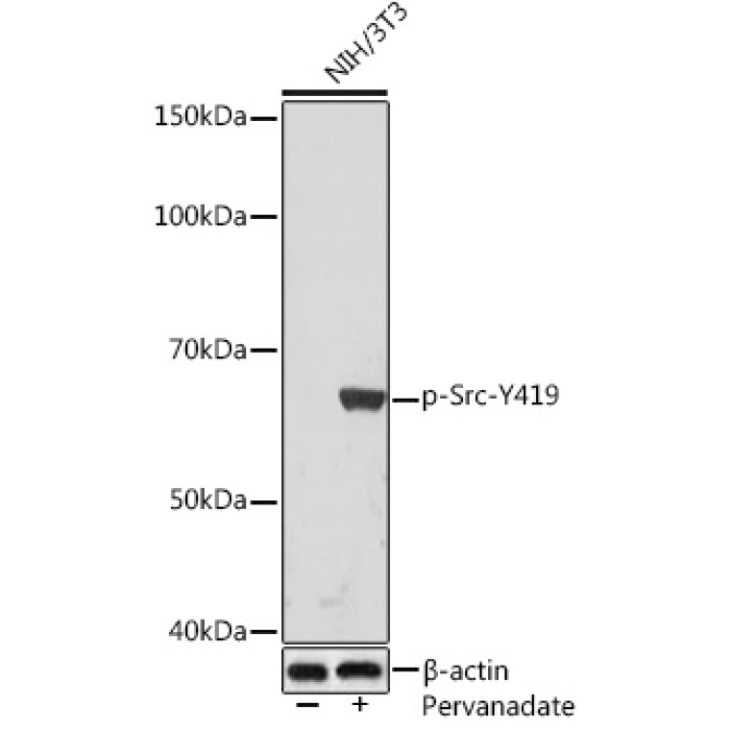 Phospho-Src-Y419 Rabbit Monoclonal Antibody