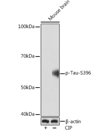 Phospho-Tau-S396 Rabbit Monoclonal Antibody