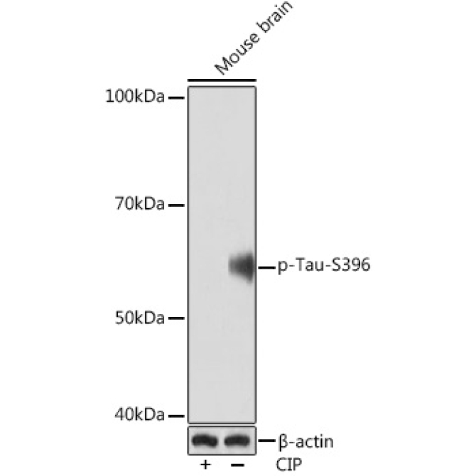 Phospho-Tau-S396 Rabbit Monoclonal Antibody