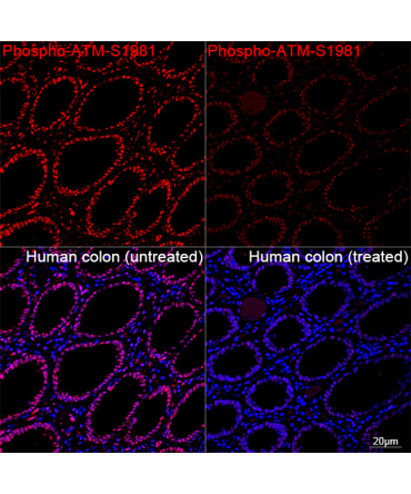Phospho-ATM-S1981 Rabbit Monoclonal Antibody