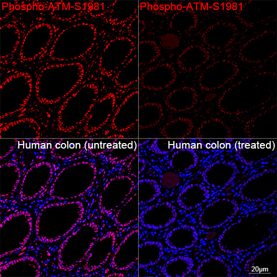 Phospho-ATM-S1981 Rabbit Monoclonal Antibody