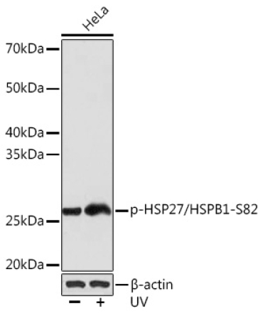 Phospho-HSP27/HSPB1-S82 Rabbit Monoclonal Antibody