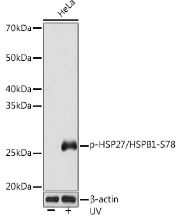 Phospho-HSP27/HSPB1-S78 Rabbit Monoclonal Antibody