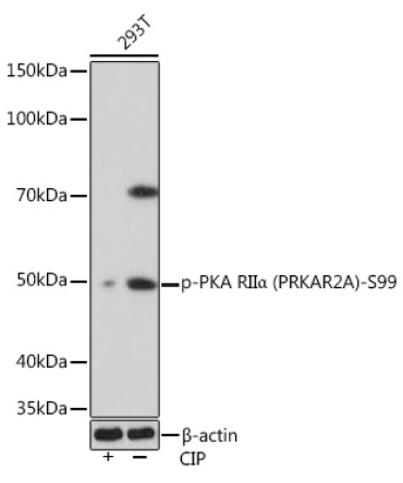 Phospho-PKA RIIAlpha (PRKAR2A)-S99 Rabbit Monoclonal Antibody