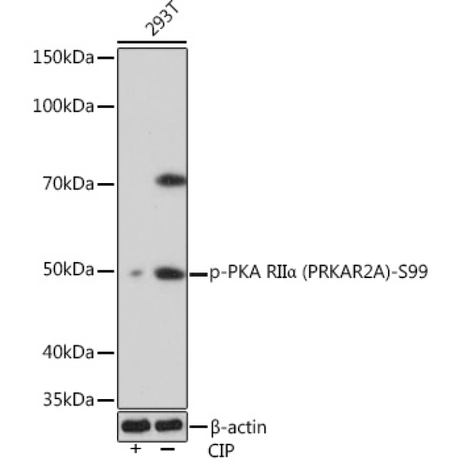 Phospho-PKA RIIAlpha (PRKAR2A)-S99 Rabbit Monoclonal Antibody