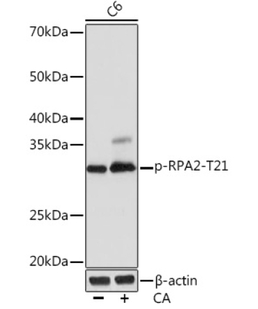 Phospho-RPA2-T21 Rabbit Monoclonal Antibody