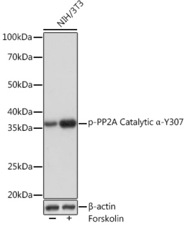 Phospho-PP2A Catalytic Alpha-Y307 Rabbit Monoclonal Antibody