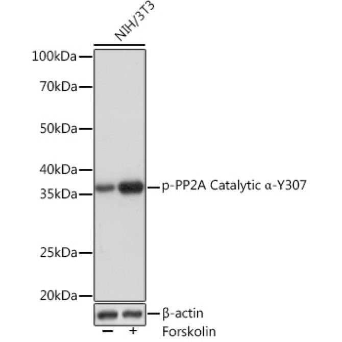 Phospho-PP2A Catalytic Alpha-Y307 Rabbit Monoclonal Antibody