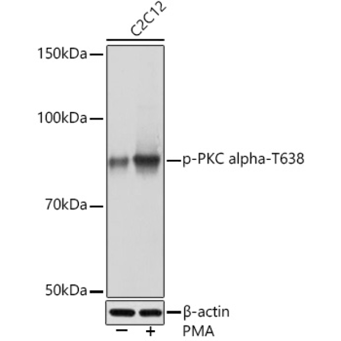 Phospho-PKC alpha-T638 Rabbit Monoclonal Antibody