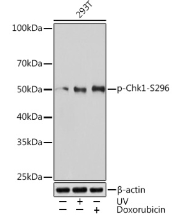 Phospho-Chk1-S296 Rabbit Monoclonal Antibody