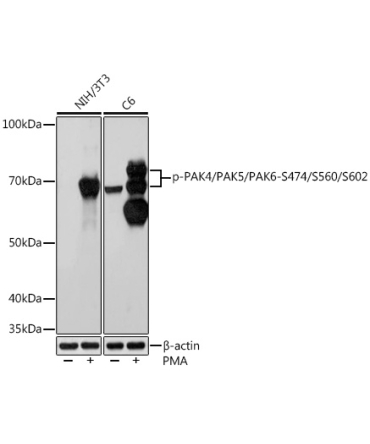 Phospho-PAK4/PAK5/PAK6-S474/S560/S602 Rabbit Monoclonal Antibody