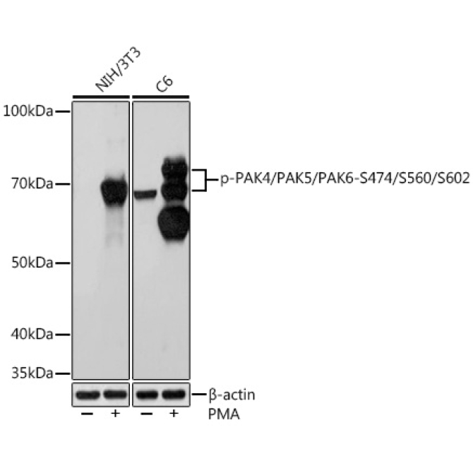 Phospho-PAK4/PAK5/PAK6-S474/S560/S602 Rabbit Monoclonal Antibody