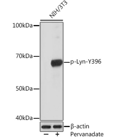 Phospho-Lyn-Y396 Rabbit Monoclonal Antibody