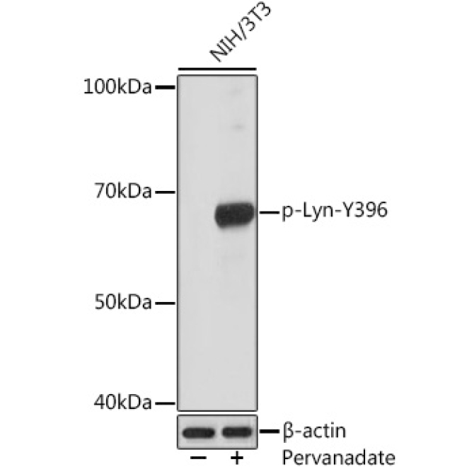 Phospho-Lyn-Y396 Rabbit Monoclonal Antibody