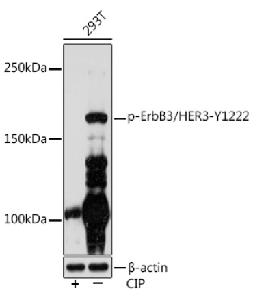 Phospho-ErbB3/HER3-Y1222 Rabbit Monoclonal Antibody