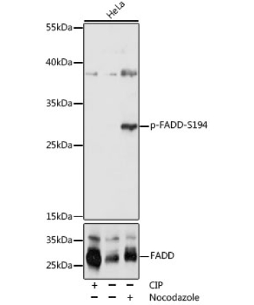 Phospho-FADD-S194 Rabbit Polyclonal Antibody