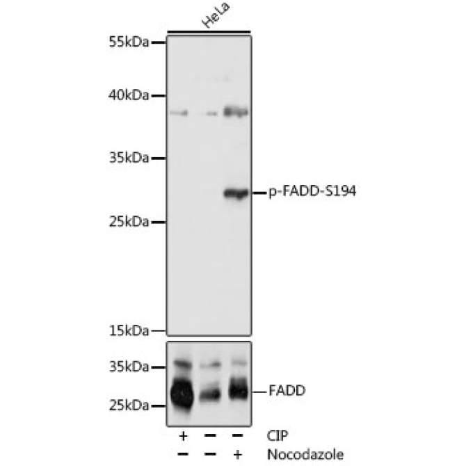 Phospho-FADD-S194 Rabbit Polyclonal Antibody