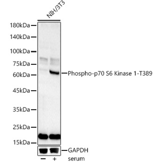 Phospho-p70 S6 Kinase 1-T389 Rabbit Polyclonal Antibody