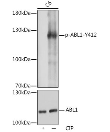 Phospho-c-Abl-Y412 Rabbit Polyclonal Antibody